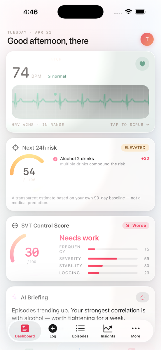 SVT Monitor dashboard showing live heart rate and ECG waveform
